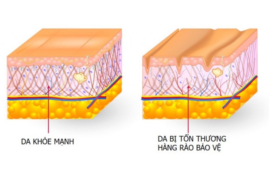 Hàng rào bảo vệ da là gì
