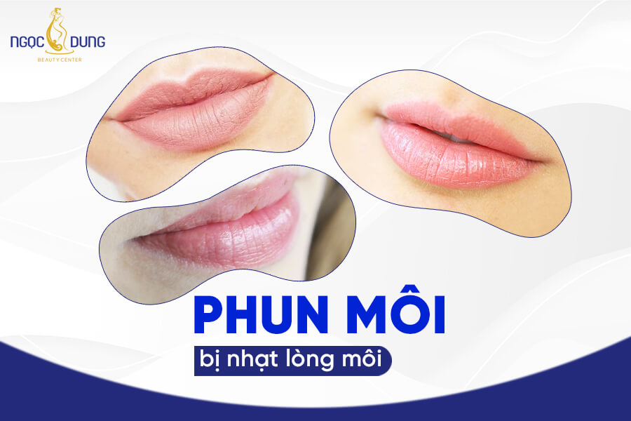Phun môi bị nhạt lòng môi do đâu? Cách xử lý như thế nào?