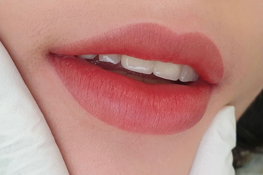 Phun môi tại TMV Ngọc Dung không sưng đau, không cần nghỉ dưỡng 