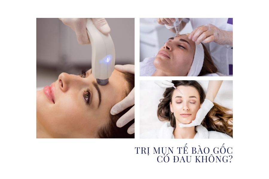 Cấy tế bào gốc có đau không? Cấy tế bào gốc có đau không?