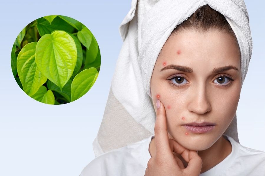 Lá trầu có chứa tinh dầu và các hợp chất phenol với khả năng chống viêm, trị mụn hiệu quả Lá trầu không kháng viêm, trị mụn