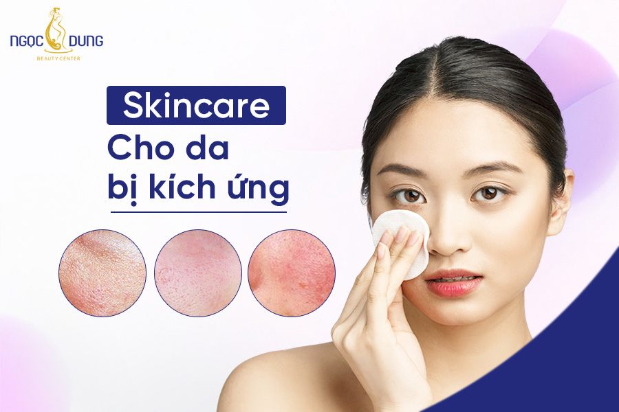 “Mách” nàng các bước skincare cho da bị kích ứng an toàn, đúng cách