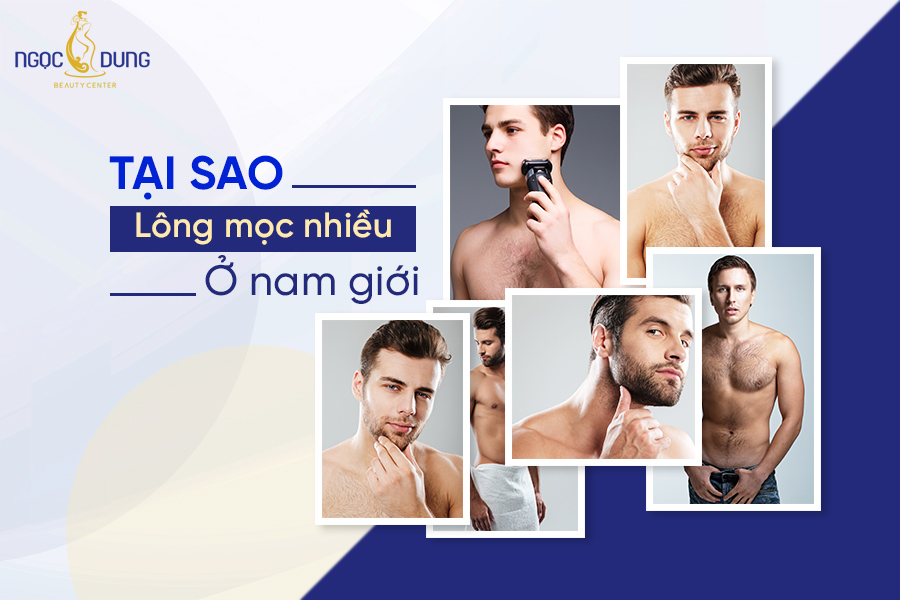 tại sao lông mọc nhiều ở nam giới