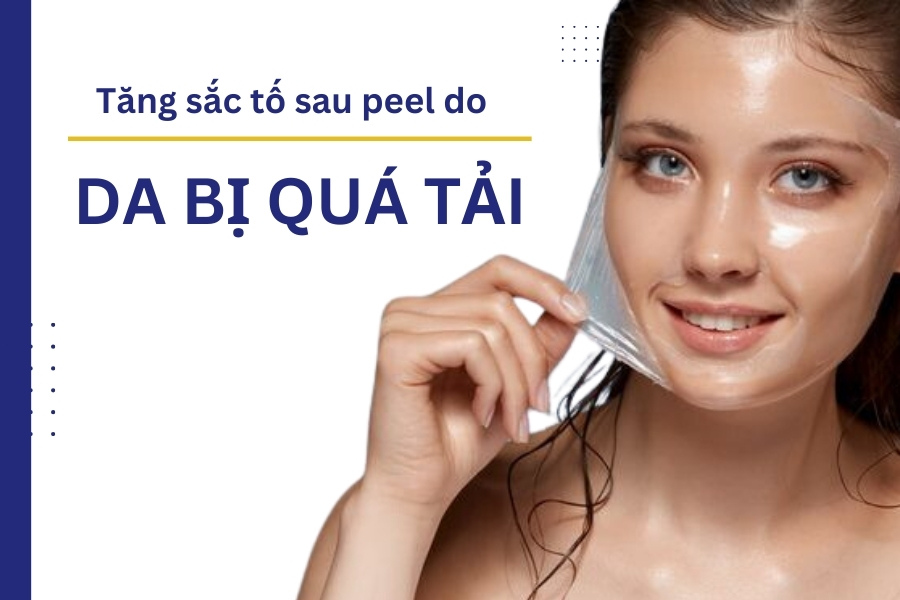 Da bị tăng sắc tố sau peel có thể là do peel da sâu, khiến làn da bị bong tróc