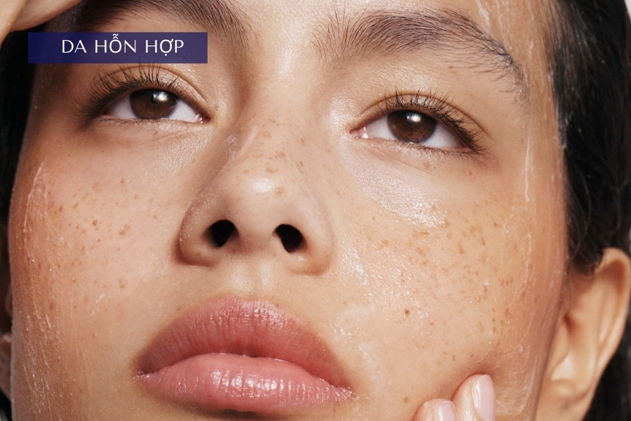 Da hỗn hợp nên dùng AHA hay BHA sẽ tốt hơn?