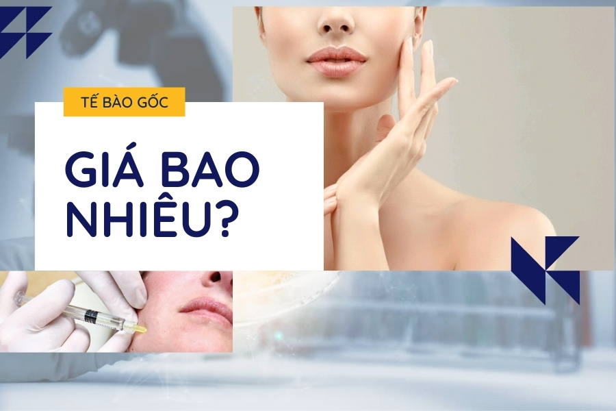 Phương pháp tế bào gốc trị mụn giá bao nhiêu? Phương pháp tế bào gốc trị mụn giá bao nhiêu?