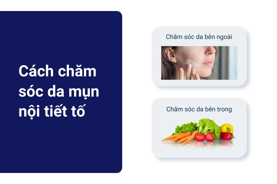 Cách chăm sóc da mụn nội tiết từ trong ra ngoài Cách chăm sóc da mụn nội tiết từ trong ra ngoài