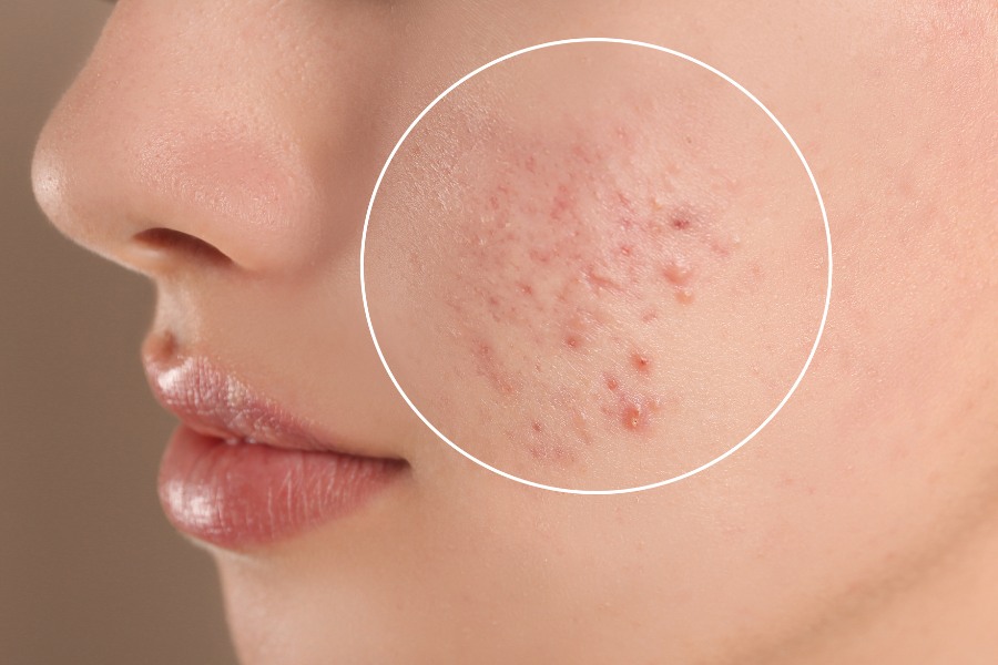 thoa dầu dừa lên mặt có tác dụng gì