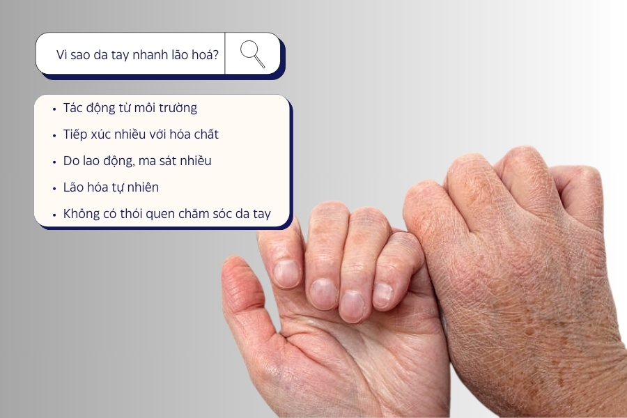 Nguyên nhân khiến bàn tay lão hóa nhanh
