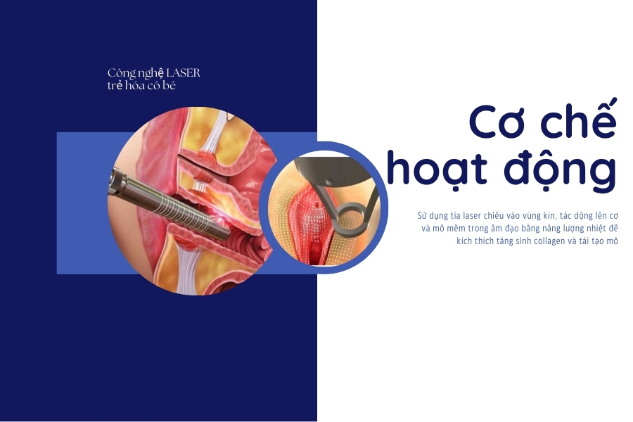 Các tia laser tạo ra nhiệt khi tác động lên vùng kín, giúp tăng sinh collagen
