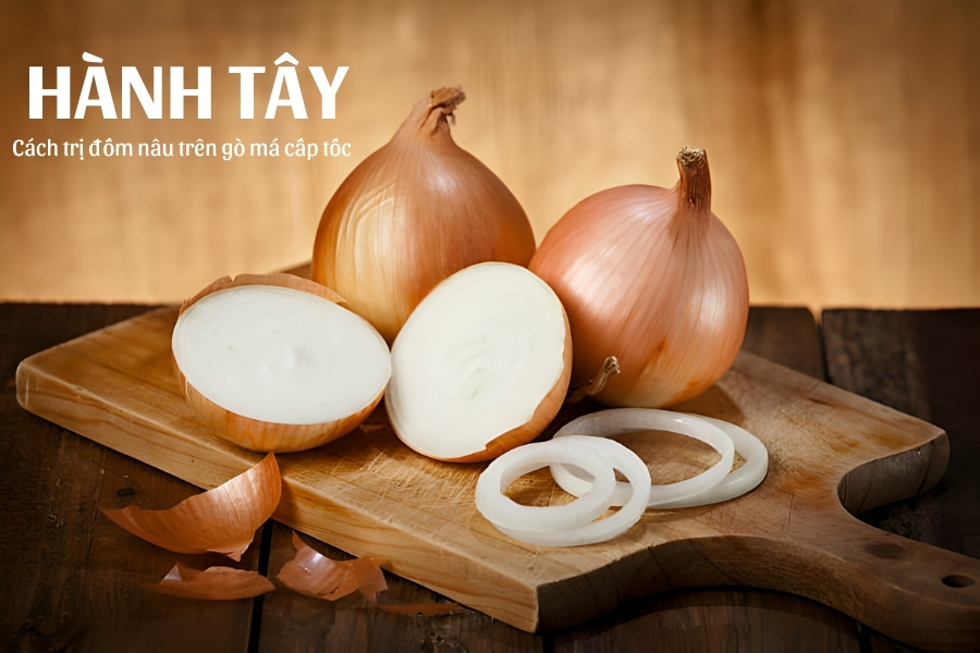 Không chỉ làm mờ các đốm nâu mà hành tây còn có tác dụng làm chậm quá trình lão hóa Không chỉ làm mờ các đốm nâu mà hành tây còn có tác dụng làm chậm quá trình lão hóa