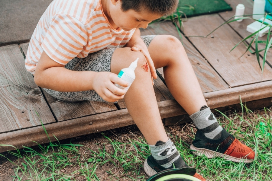 Sử dụng oxy già hoặc povidone iod để làm sạch vết thương