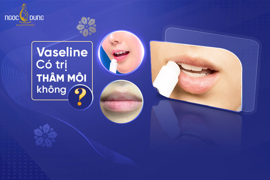 Vaseline có trị thâm môi không? Cách dưỡng môi bằng vaseline