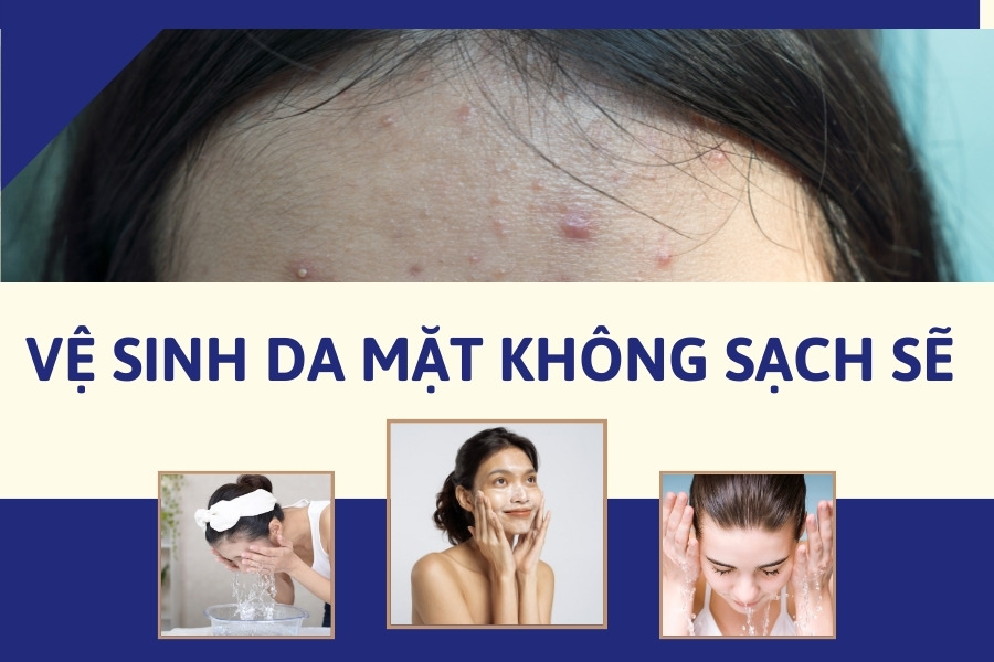 Vệ sinh da mặt qua loa sẽ làm cho các bụi bẩn tích tụ lại trên da và gây mụn Vệ sinh da mặt qua loa sẽ làm cho các bụi bẩn tích tụ lại trên da và gây mụn