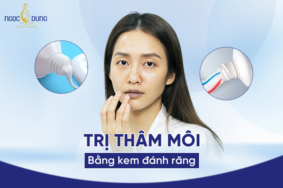 7 Cách trị thâm môi bằng kem đánh răng dễ thực hiện tại nhà