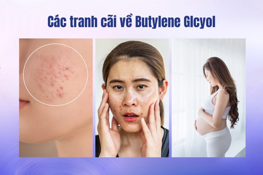 Các tranh cãi thường gặp về Butylene Glycol là gì