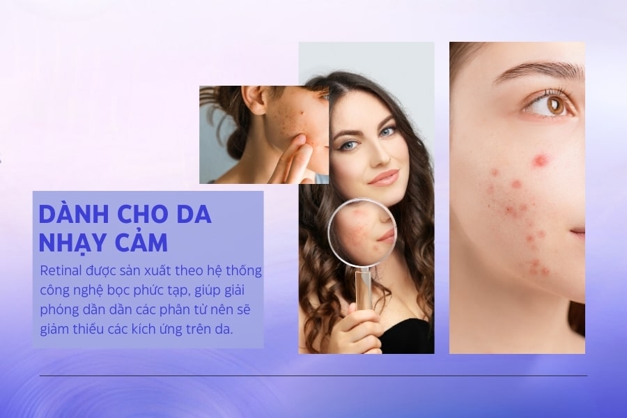 Hỗ trợ cho làn da nhạy cảm tốt hơn Retinol Hỗ trợ cho làn da nhạy cảm tốt hơn Retinol