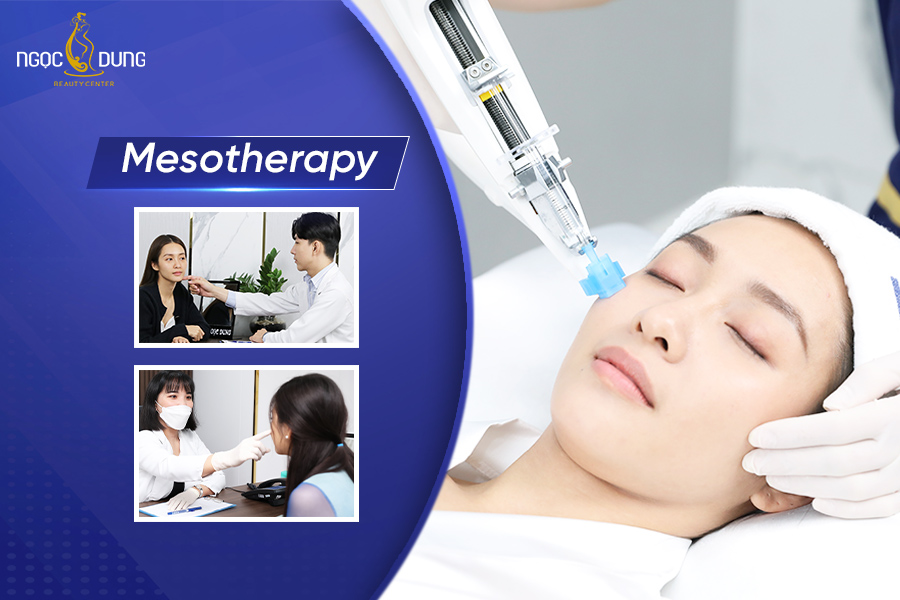 Liệu pháp Mesotherapy là gì? Ưu nhược điểm của tiêm Meso Liệu pháp Mesotherapy là gì? Ưu nhược điểm của tiêm Meso