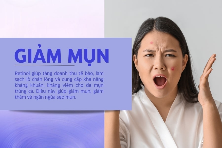 Ngăn ngừa và giảm mụn trứng cá Ngăn ngừa và giảm mụn trứng cá