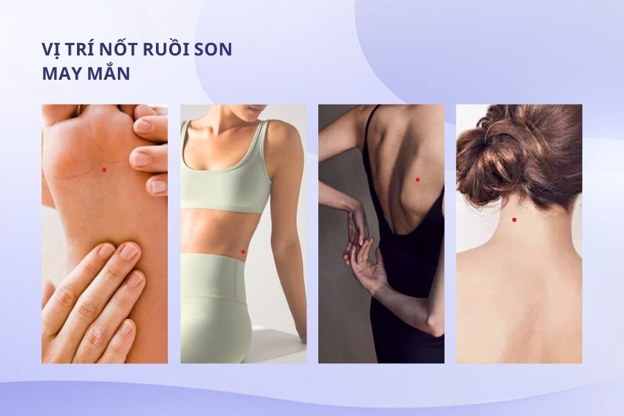 Những vị trí nốt ruồi đỏ sẽ mang lại may mắn cho người sở hữu Những vị trí nốt ruồi đỏ sẽ mang lại may mắn cho người sở hữu