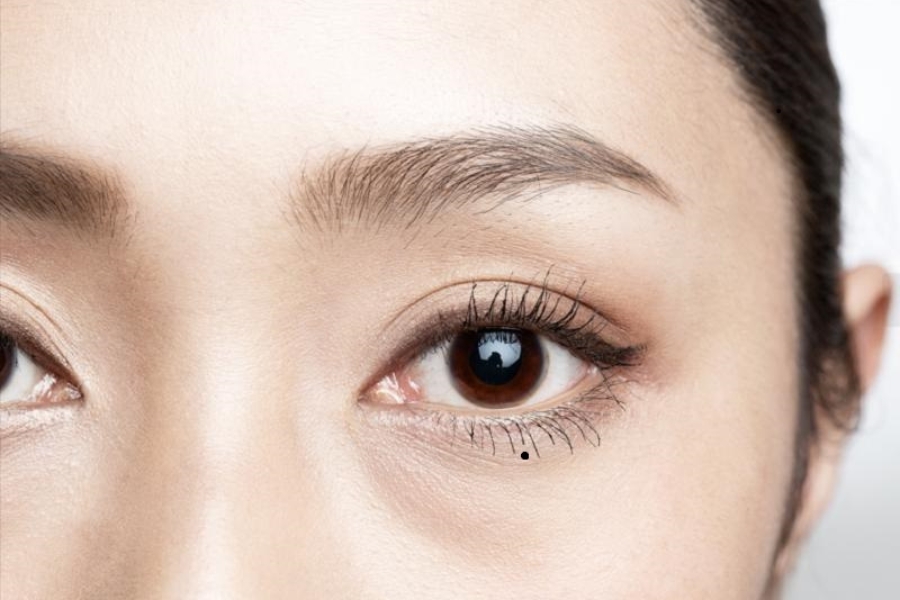 Nốt ruồi bọng mắt - Nốt ruồi đón lệ, vất vả đường con cái