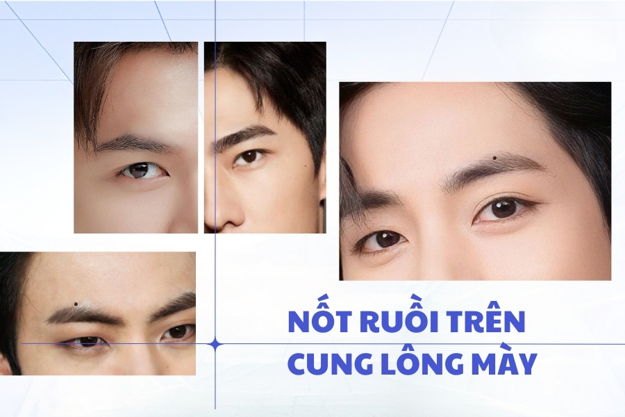 Nốt ruồi xấu trên mặt đàn ông nằm trêm cung lông mày