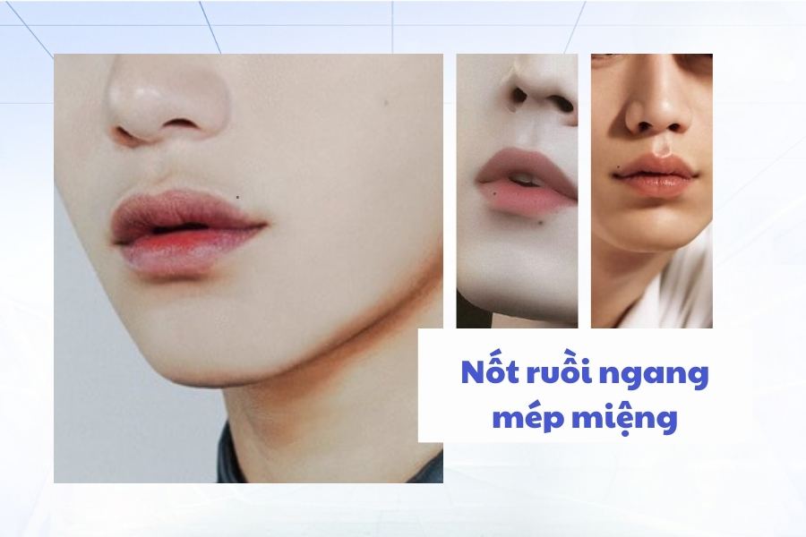 Nốt ruồi nằm ở vị trí ngang mép - Người ích kỷ, hẹp hòi