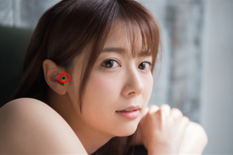 Nốt ruồi ở bình nhĩ -  Một dạ, hai lòng trong tình yêu