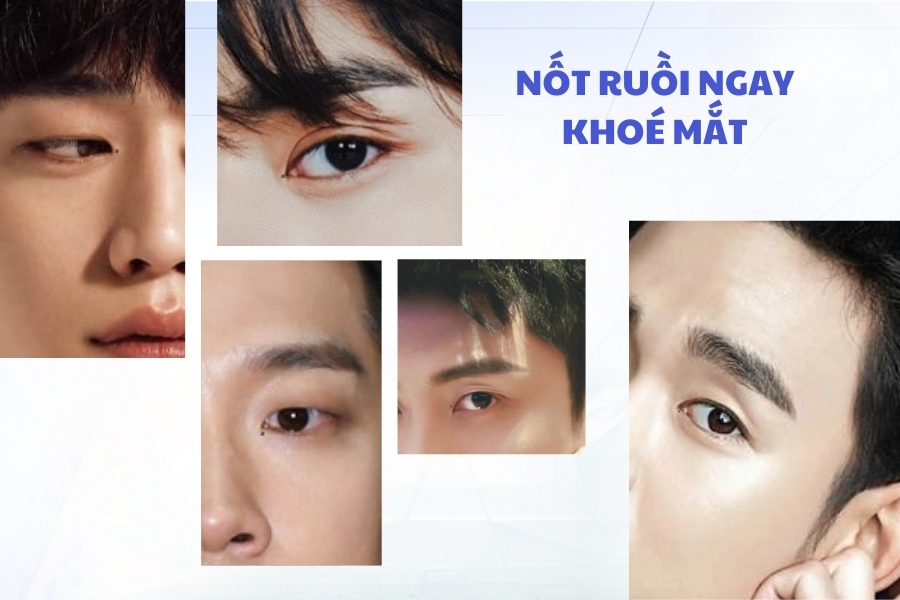 Nốt ruồi ở ngay dưới khóe mắt - Tướng phá tài