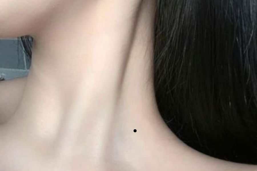 Nốt ruồi ở phía bên trái cổ - Lấy chồng muộn đỡ lao đao