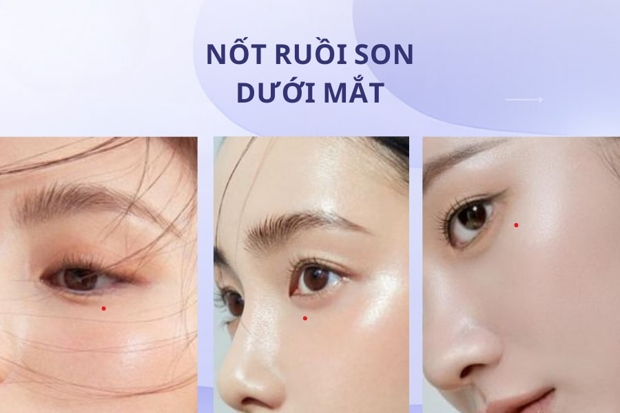 Nốt ruồi son ở đâu thì tốt nhất cho nam và nữ? Nốt ruồi son ở đâu thì tốt nhất cho nam và nữ?