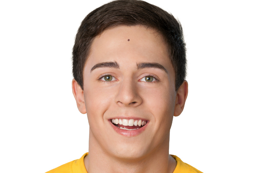 Nốt ruồi trên đỉnh trán nam là những người xuất thân từ gia đình có điều kiện và sở hữu trí tuệ đặc biệt Nốt ruồi trên đỉnh trán nam là những người xuất thân từ gia đình có điều kiện và sở hữu trí tuệ đặc biệt