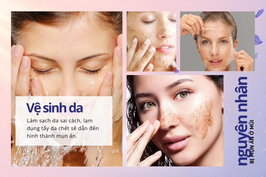 Vệ sinh da vùng mũi không đúng cách Vệ sinh da vùng mũi không đúng cách