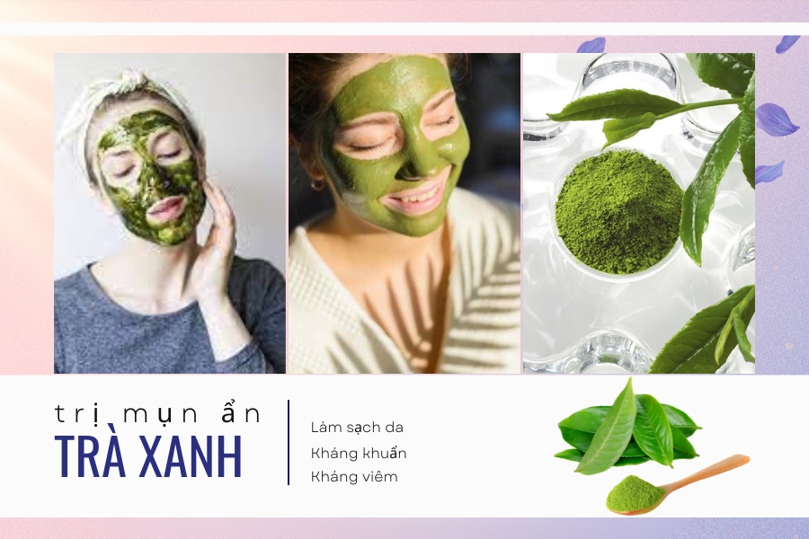 Xóa mụn ẩn trên cánh mũi với trà xanh Xóa mụn ẩn trên cánh mũi với trà xanh