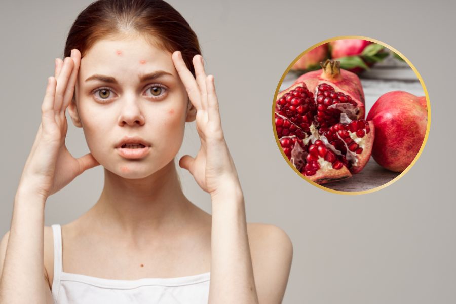 Ăn lựu có nổi mụn không? Ăn lựu có thể gây nổi mụn nếu ăn quá mức khuyến nghị Ăn lựu có nổi mụn không? Ăn lựu có thể gây nổi mụn nếu ăn quá mức khuyến nghị