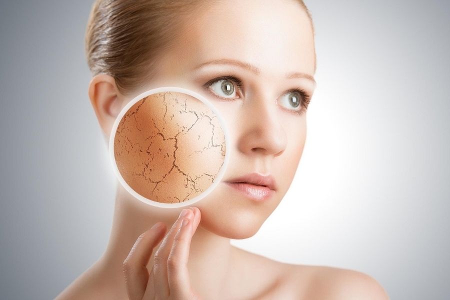 Bệnh da rắn được phân loại là tình trạng da trở nên khô và nứt nẻ, có vẻ ngoài giống như vảy rắn