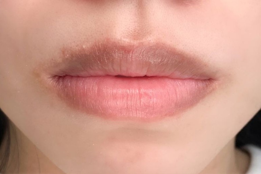 cách để môi hồng tự nhiên