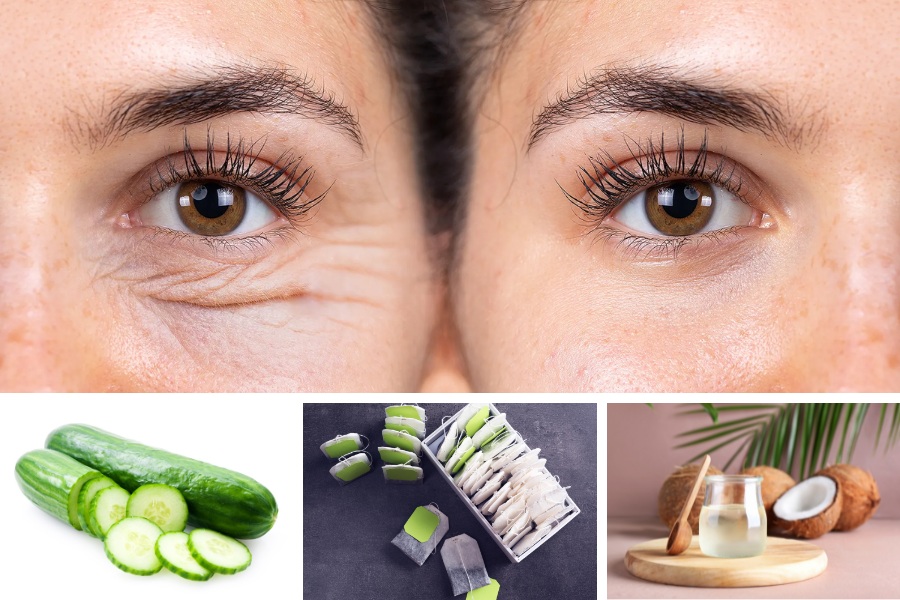 Cách làm trẻ hóa đôi mắt bằng những nguyên liệu sẵn có tại nhà Cách làm trẻ hóa đôi mắt bằng những nguyên liệu sẵn có tại nhà