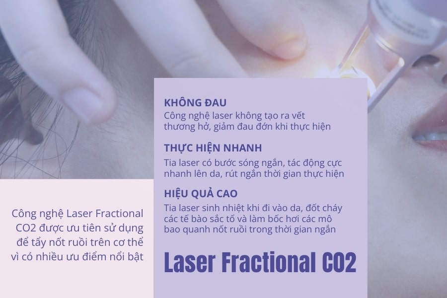 TMV Ngọc Dung - Địa chỉ tẩy, xóa nốt ruồi bằng laser an toàn, hiệu quả