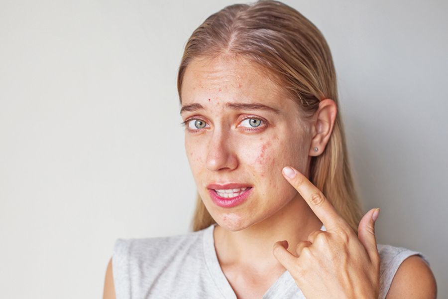 Thời gian phục hồi da nhiễm corticoid ở mỗi người là khác nhau