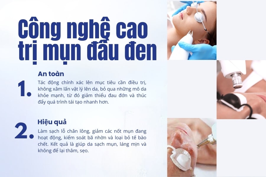 Trị mụn đầu đen ở mũi tận gốc bằng công nghệ cao
