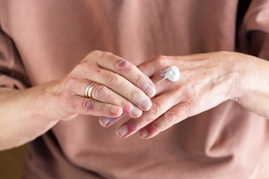 Chăm sóc da da kỹ lưỡng sau khi vết thương lành lại Chăm sóc da da kỹ lưỡng sau khi vết thương lành lại