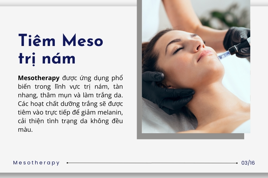 Tiêm Mesotherapy có tốt không? Tiêm Mesotherapy có tốt không?