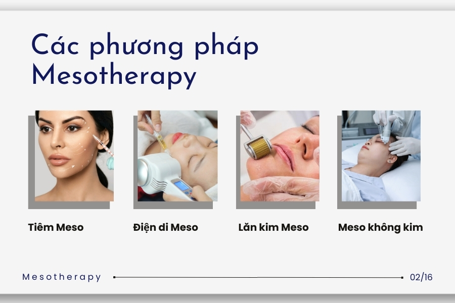 Các phương pháp Meso được ứng dụng phổ biến trên thị trường Các phương pháp Meso được ứng dụng phổ biến trên thị trường