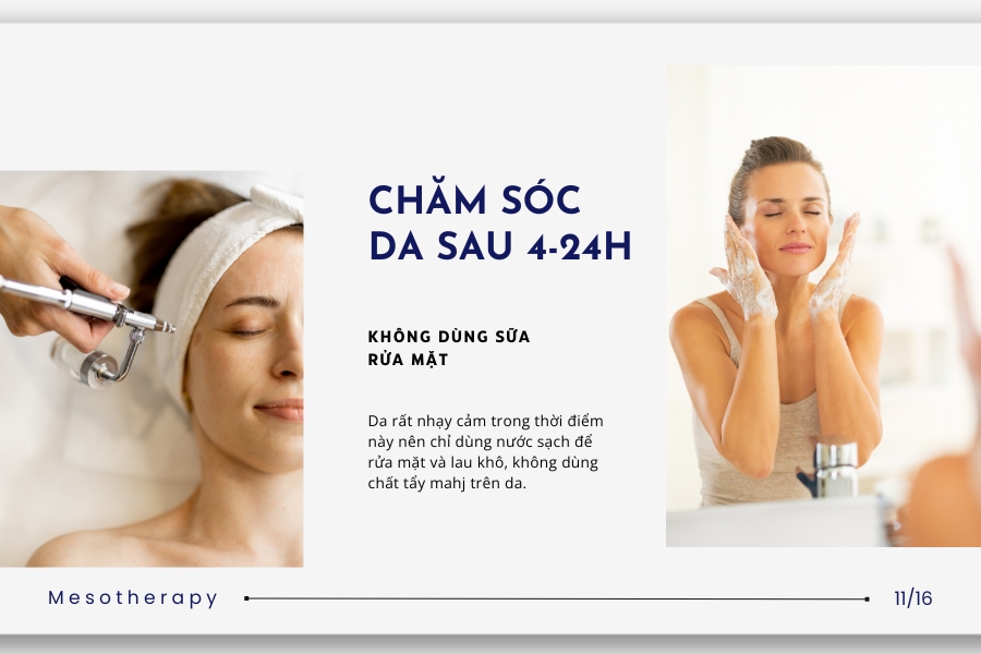 Hướng dẫn cách chăm sóc da sau tiêm Meso Hướng dẫn cách chăm sóc da sau tiêm Meso