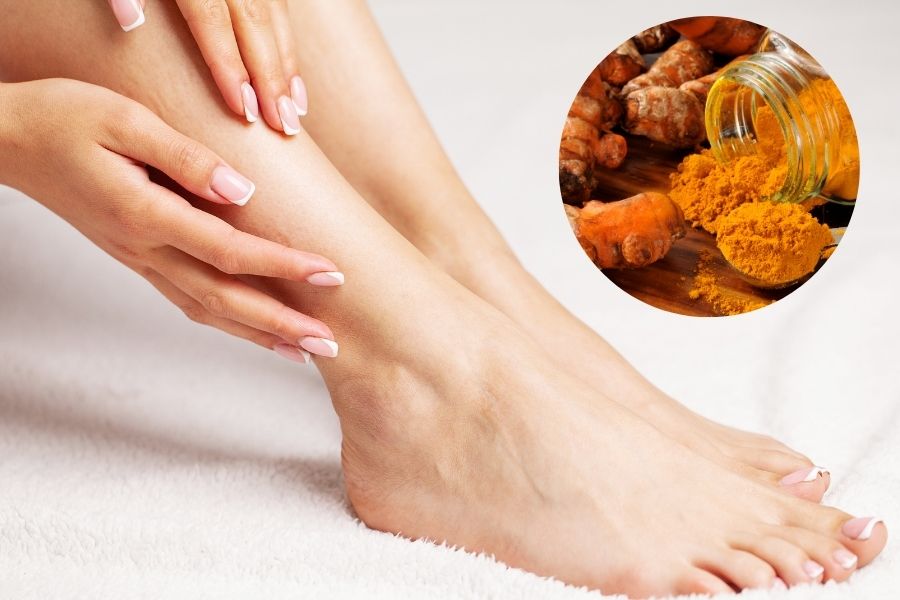 Nhờ khả năng kháng khuẩn và làm dịu da, nghệ tươi giúp làm giảm bớt tình trạng chai mắt cá chân hiệu quả Trị mắt cá chân chai sần với nghệ và mật ong