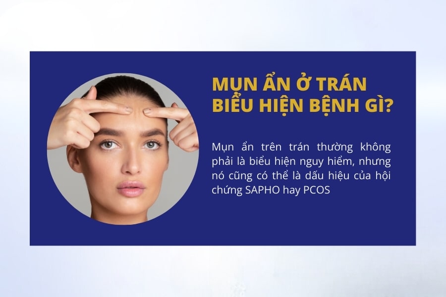 Mụn ẩn ở trán biểu hiện bệnh gì? Mụn ẩn ở trán biểu hiện bệnh gì?