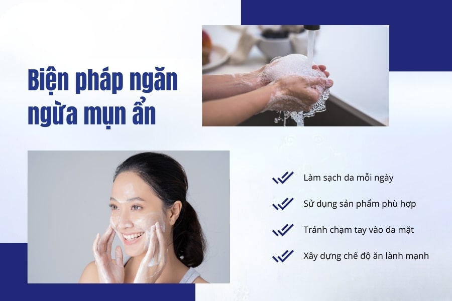 Một số biện pháp ngăn ngừa nổi mụn ẩn ở trán Một số biện pháp ngăn ngừa nổi mụn ẩn ở trán