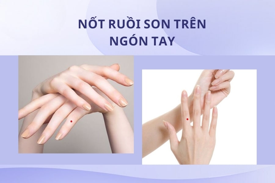 Xem tướng mụn ruồi son trên các ngón tay nam nữ Xem tướng mụn ruồi son trên các ngón tay nam nữ