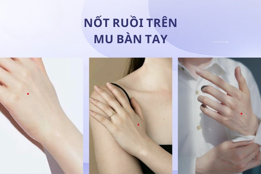 Mụn ruồi son là nốt ruồi như thế nào trong nhân tướng học? Mụn ruồi son là nốt ruồi như thế nào trong nhân tướng học?